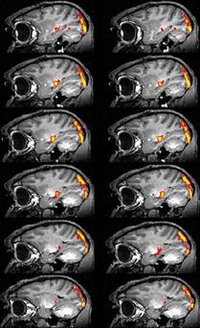 A series of fMRI sections of a monkey brain.