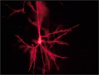 Nervenzelle im Lichtmikroskop